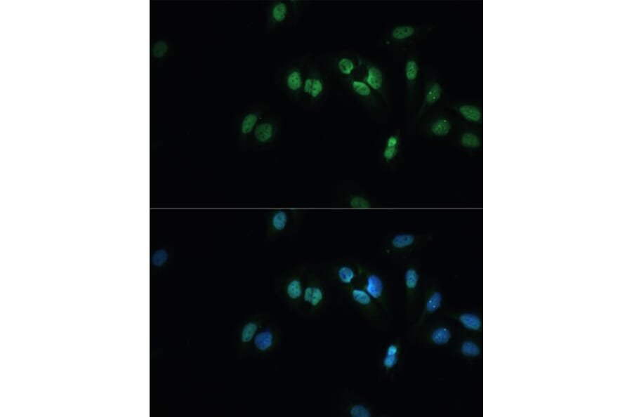 Immunofluorescence - Anti-TDP43 Antibody (A92740) - Antibodies.com