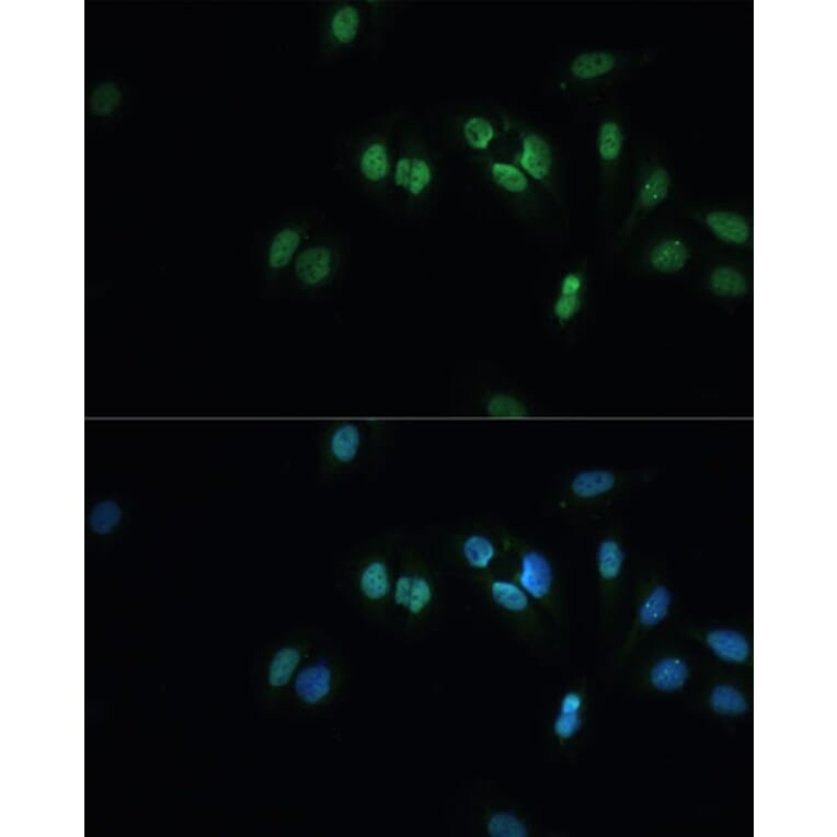 Immunofluorescence - Anti-TDP43 Antibody (A92740) - Antibodies.com