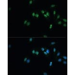 Immunofluorescence - Anti-TDP43 Antibody (A92740) - Antibodies.com