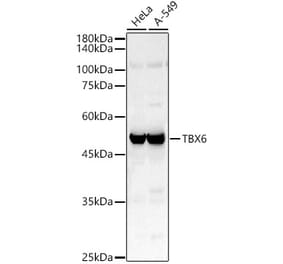 Western Blot - Anti-Tbx6 Antibody (A92741) - Antibodies.com