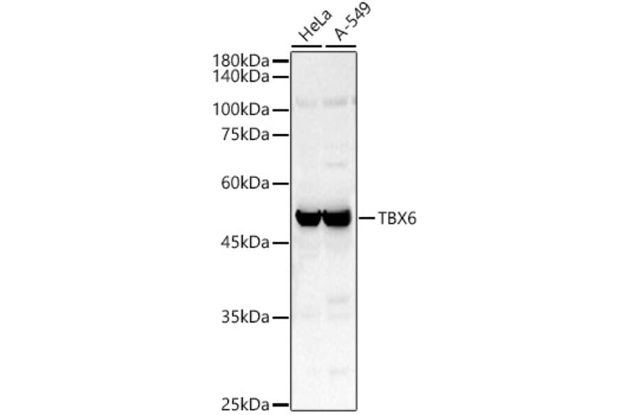 Western Blot - Anti-Tbx6 Antibody (A92741) - Antibodies.com