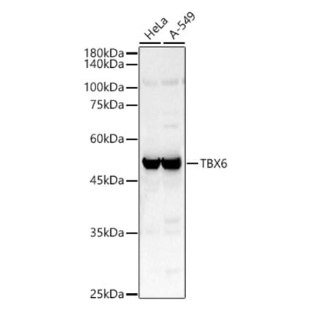 Western Blot - Anti-Tbx6 Antibody (A92741) - Antibodies.com