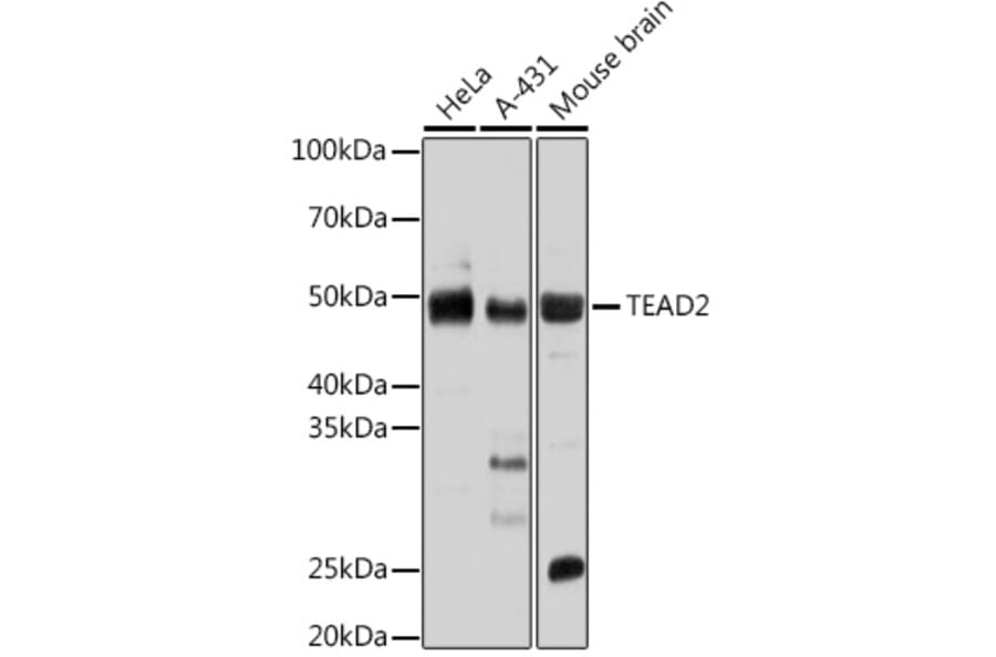 Western Blot - Anti-TEA domain family member 2 / ETF Antibody (A92742) - Antibodies.com