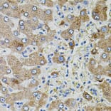 Immunohistochemistry - Anti-TGFA Antibody (A12522) - Antibodies.com