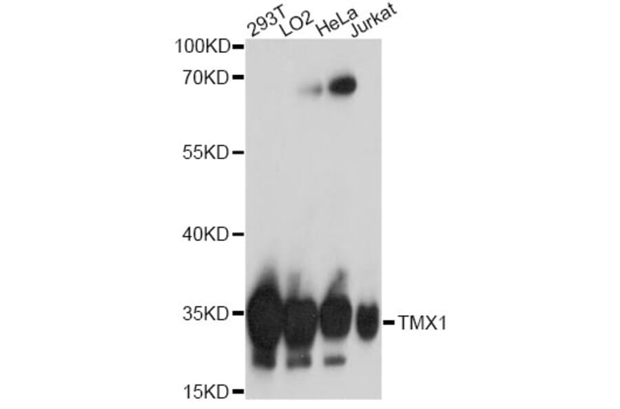 Western Blot - Anti-TXNDC/TMX Antibody (A92746) - Antibodies.com