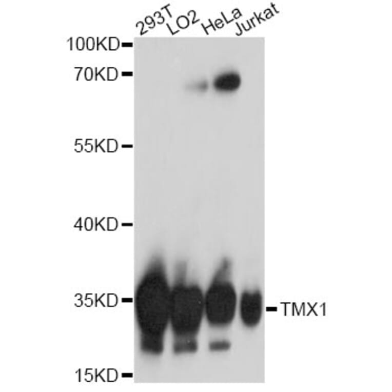 Western Blot - Anti-TXNDC/TMX Antibody (A92746) - Antibodies.com