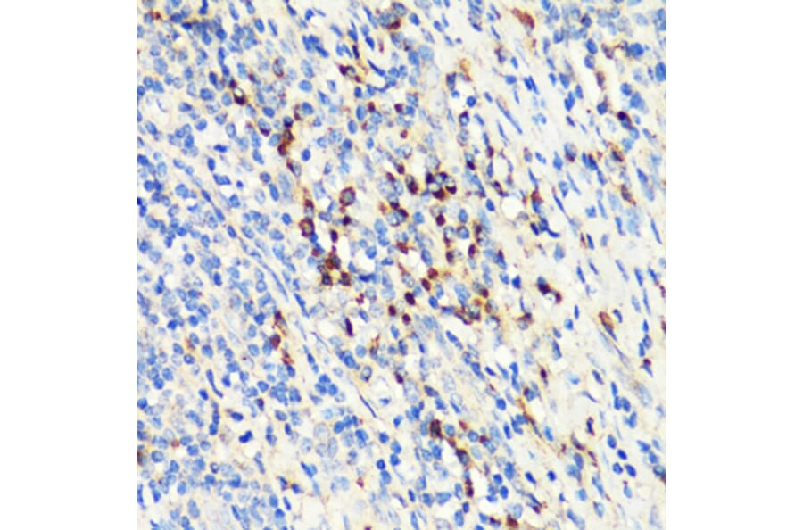 Immunohistochemistry - Anti-RANKL Antibody (A92747) - Antibodies.com
