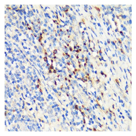 Immunohistochemistry - Anti-RANKL Antibody (A92747) - Antibodies.com