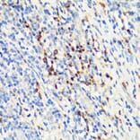 Immunohistochemistry - Anti-RANKL Antibody (A92747) - Antibodies.com