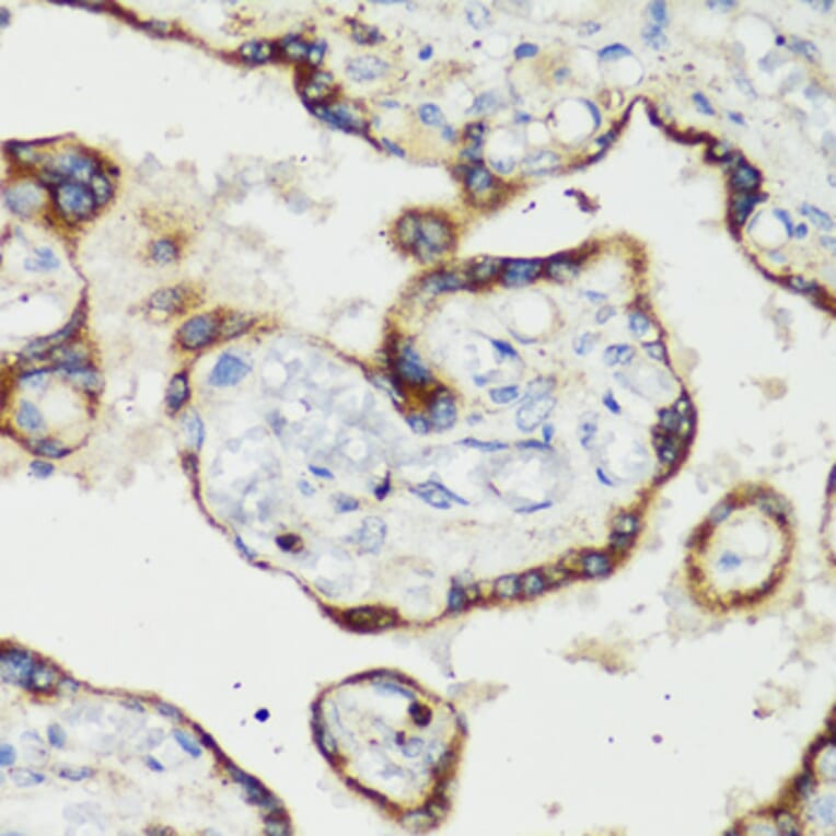 Immunohistochemistry - Anti-RANKL Antibody (A92747) - Antibodies.com