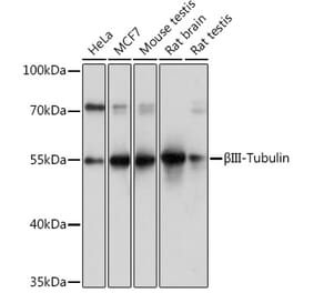Western Blot - Anti-beta III Tubulin Antibody (A92748) - Antibodies.com