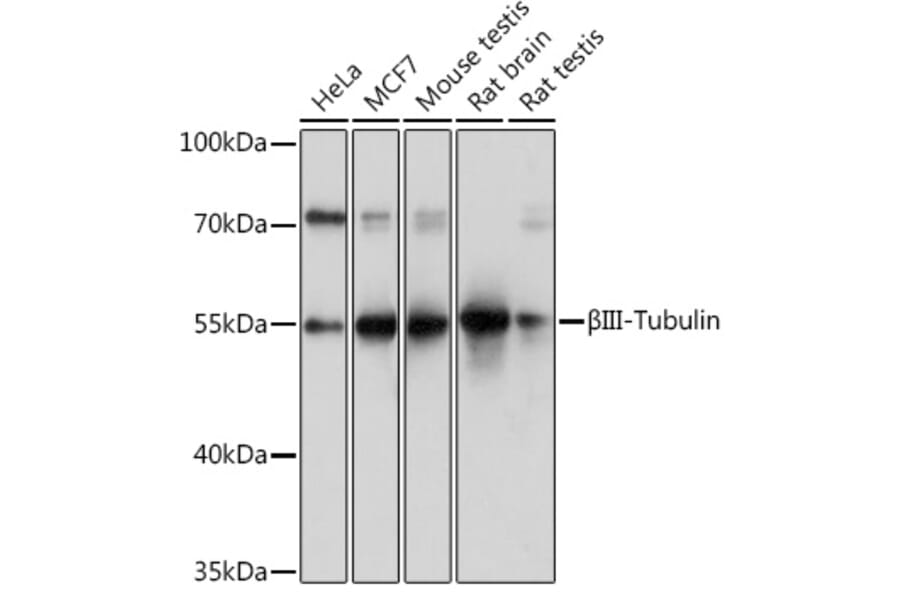 Western Blot - Anti-beta III Tubulin Antibody (A92748) - Antibodies.com
