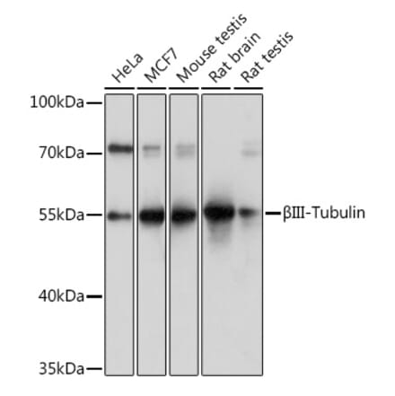 Western Blot - Anti-beta III Tubulin Antibody (A92748) - Antibodies.com