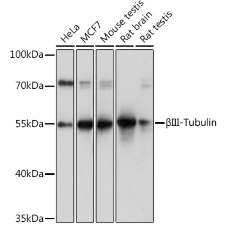 Western Blot - Anti-beta III Tubulin Antibody (A92748) - Antibodies.com