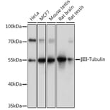 Western Blot - Anti-beta III Tubulin Antibody (A92748) - Antibodies.com