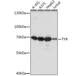 Western Blot - Anti-Tyrosinase Antibody (A92749) - Antibodies.com