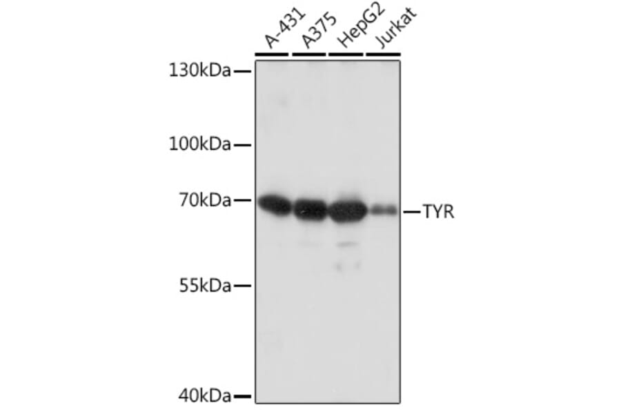 Western Blot - Anti-Tyrosinase Antibody (A92749) - Antibodies.com