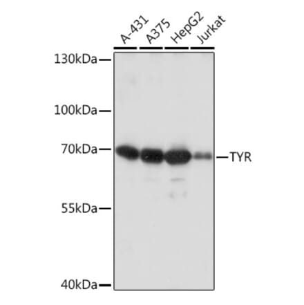 Western Blot - Anti-Tyrosinase Antibody (A92749) - Antibodies.com