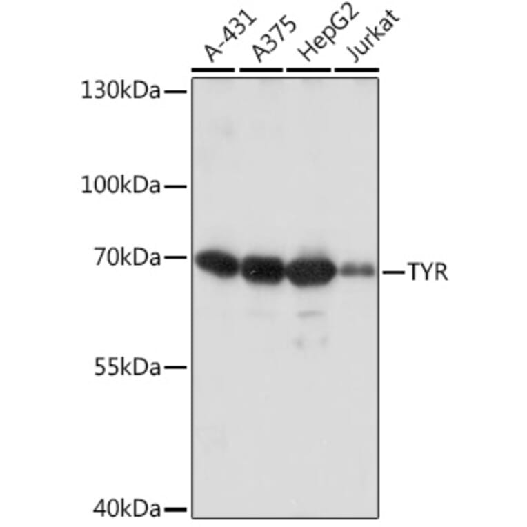 Western Blot - Anti-Tyrosinase Antibody (A92749) - Antibodies.com