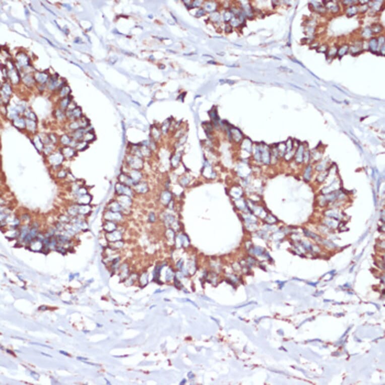 Immunohistochemistry - Anti-UBE2O Antibody (A92752) - Antibodies.com