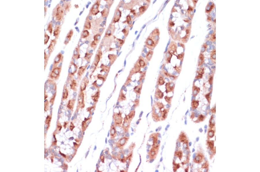 Immunohistochemistry - Anti-UBE2O Antibody (A92752) - Antibodies.com
