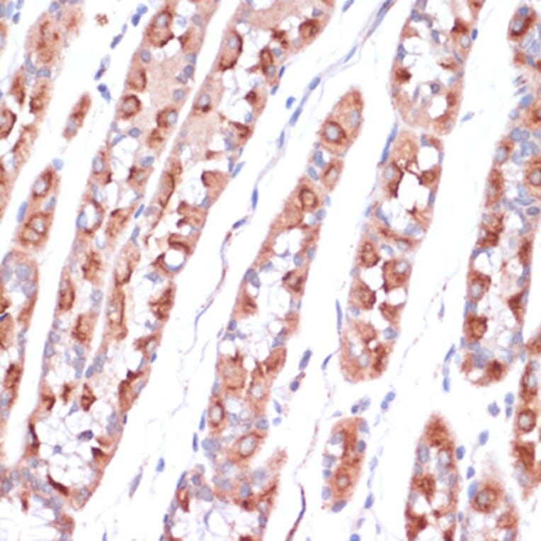 Immunohistochemistry - Anti-UBE2O Antibody (A92752) - Antibodies.com