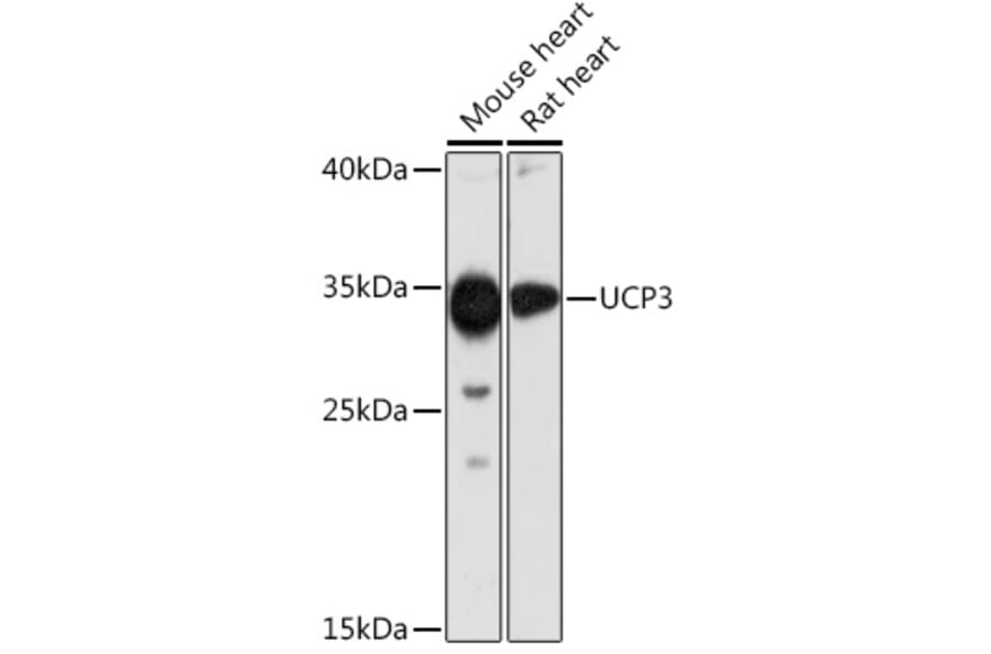 Western Blot - Anti-UCP3 Antibody (A92753) - Antibodies.com