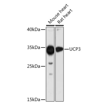Western Blot - Anti-UCP3 Antibody (A92753) - Antibodies.com