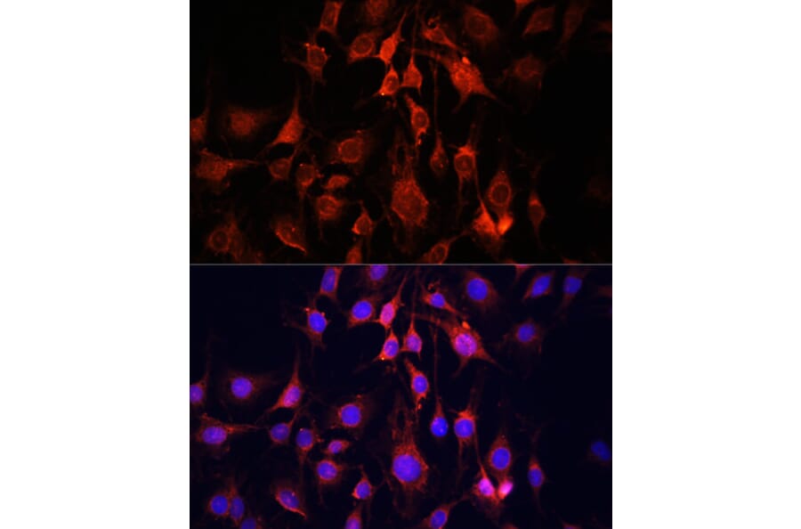 Immunofluorescence - Anti-UCP3 Antibody (A92753) - Antibodies.com