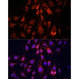 Immunofluorescence - Anti-UCP3 Antibody (A92753) - Antibodies.com