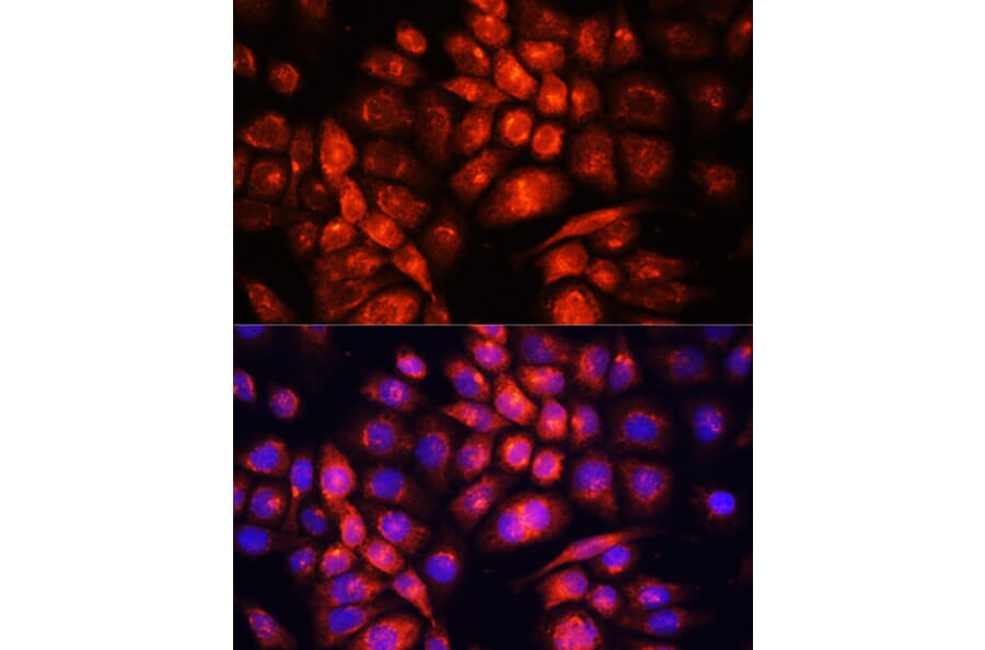 Immunofluorescence - Anti-UCP3 Antibody (A92753) - Antibodies.com