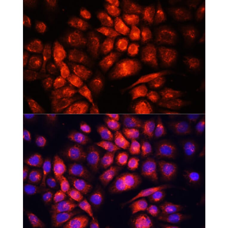 Immunofluorescence - Anti-UCP3 Antibody (A92753) - Antibodies.com