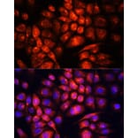 Immunofluorescence - Anti-UCP3 Antibody (A92753) - Antibodies.com