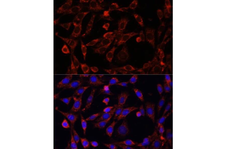 Immunofluorescence - Anti-UCP3 Antibody (A92753) - Antibodies.com