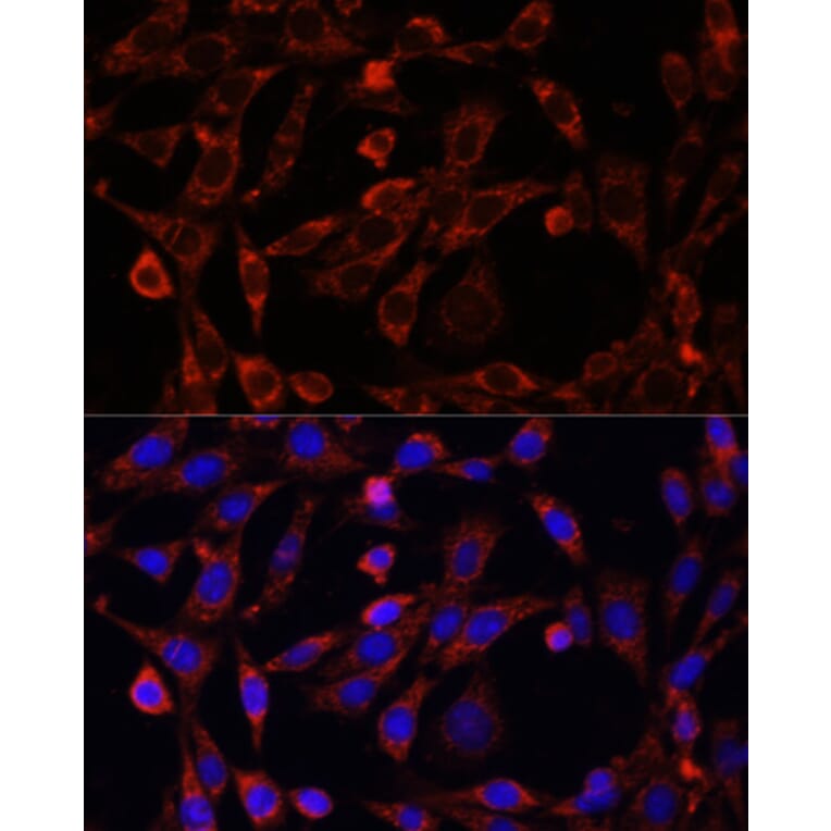 Immunofluorescence - Anti-UCP3 Antibody (A92753) - Antibodies.com