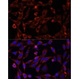 Immunofluorescence - Anti-UCP3 Antibody (A92753) - Antibodies.com