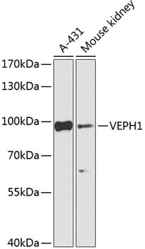 Western blot analysis of extracts of various cell lines, using Anti-VEPH1 Antibody (A15228) at 1:1,000 dilution.
Secondary antibody: Goat Anti-Rabbit IgG (H+L) (HRP) (AS014) at 1:10,000 dilution.
Lysates / proteins: 25µg per lane.
Blocking buffer: 3% non-fat dry milk in TBST.
Detection: ECL Enhanced Kit (RM00021).
Exposure time: 5s.