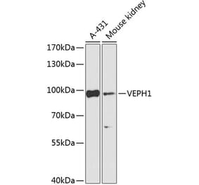 Western Blot - Anti-VEPH1 Antibody (A92754) - Antibodies.com