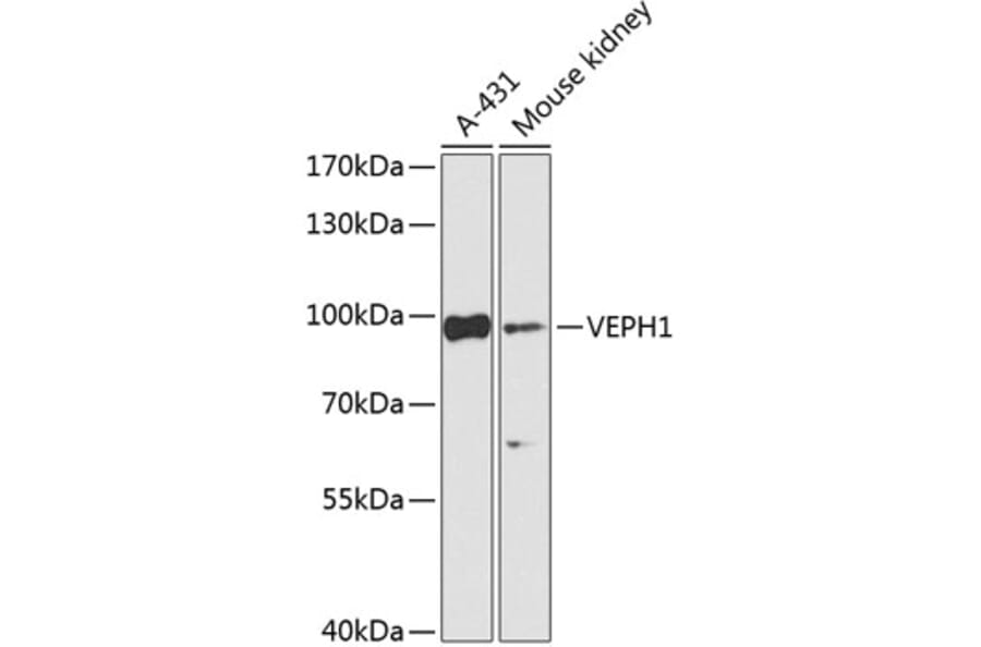 Western Blot - Anti-VEPH1 Antibody (A92754) - Antibodies.com