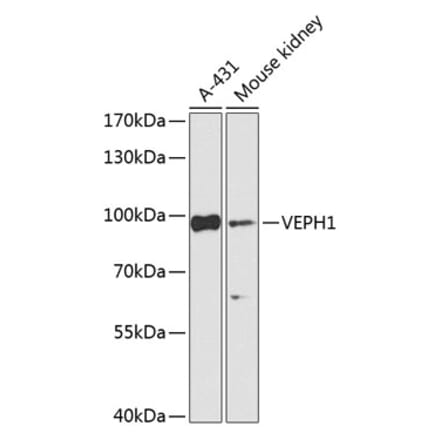Western Blot - Anti-VEPH1 Antibody (A92754) - Antibodies.com