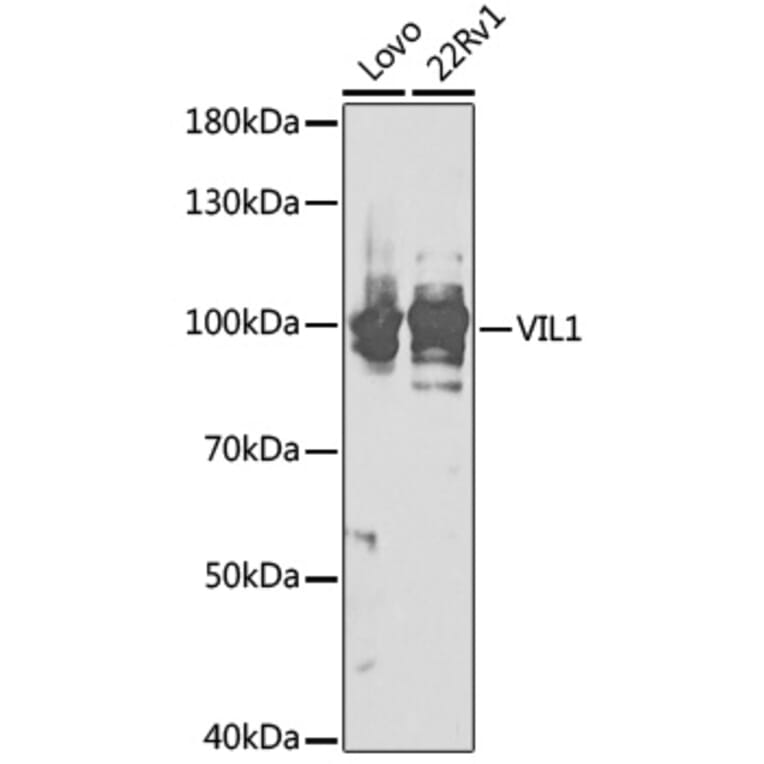 Western Blot - Anti-VIL1 Antibody (A17002) - Antibodies.com