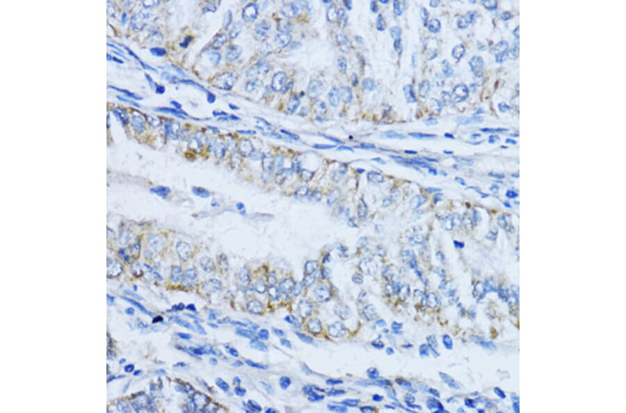 Immunohistochemistry - Anti-VIL1 Antibody (A17002) - Antibodies.com