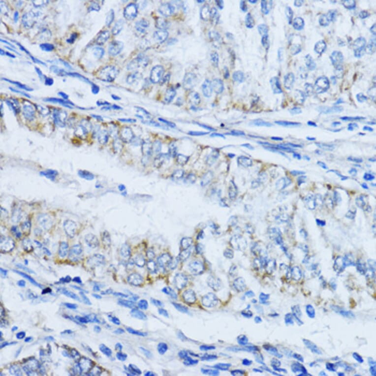 Immunohistochemistry - Anti-VIL1 Antibody (A17002) - Antibodies.com