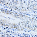 Immunohistochemistry - Anti-VIL1 Antibody (A17002) - Antibodies.com