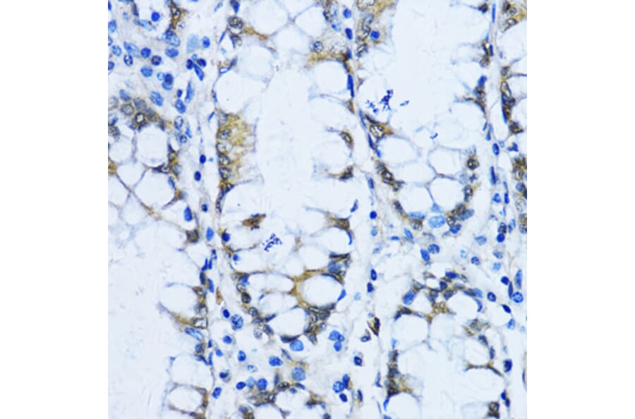 Immunohistochemistry - Anti-VIL1 Antibody (A17002) - Antibodies.com