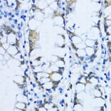 Immunohistochemistry - Anti-VIL1 Antibody (A17002) - Antibodies.com