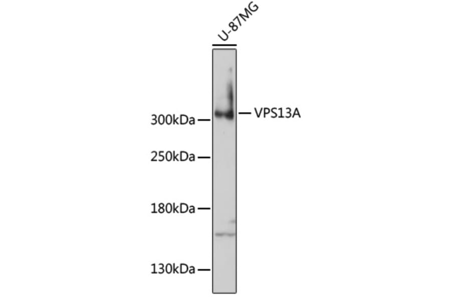 Western Blot - Anti-VPS13A Antibody (A92756) - Antibodies.com