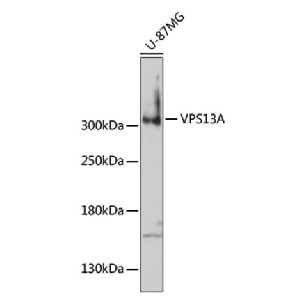 Western Blot - Anti-VPS13A Antibody (A92756) - Antibodies.com