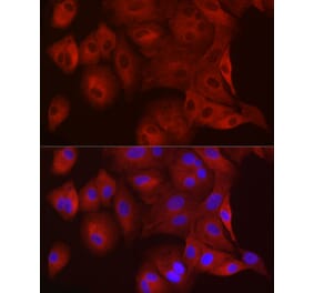 Immunofluorescence - Anti-WISP2 Antibody (A92758) - Antibodies.com