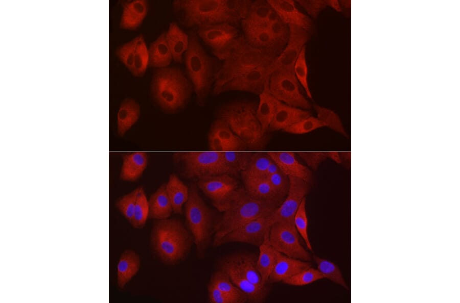 Immunofluorescence - Anti-WISP2 Antibody (A92758) - Antibodies.com